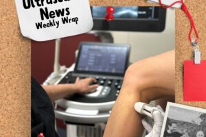 The Zedu weekly wrap - bringing together the best in free ultrasound news, views and opinions from across the internet.