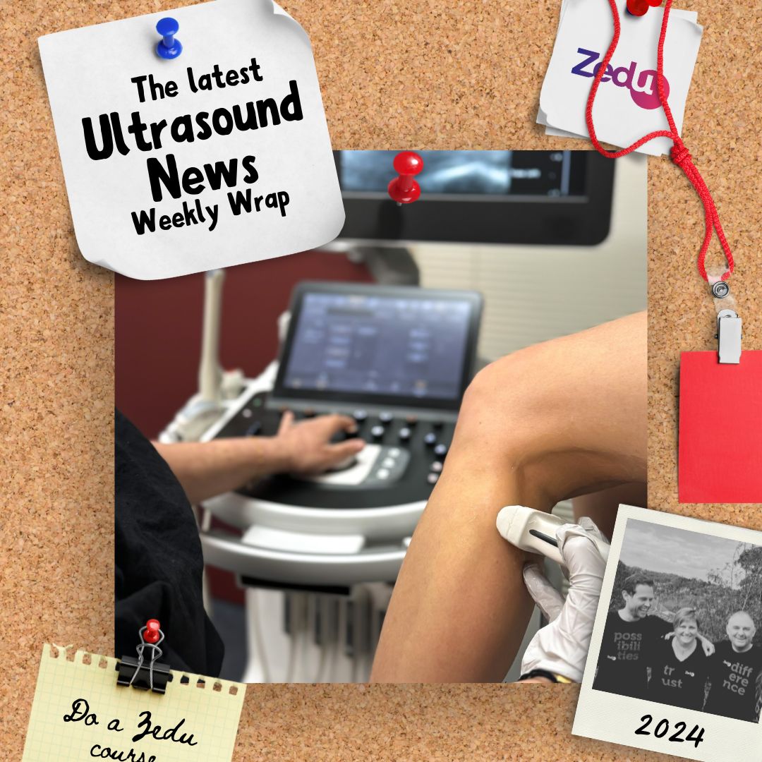 The Zedu weekly wrap - bringing together the best in free ultrasound news, views and opinions from across the internet.