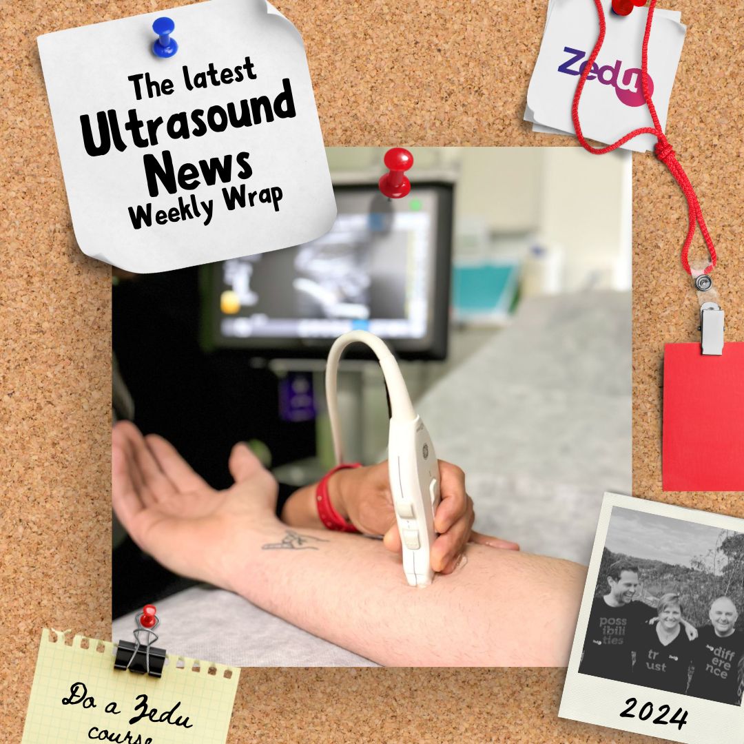 The Zedu weekly wrap - bringing together the best in free ultrasound news, views and opinions from across the internet.