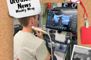 The Zedu weekly wrap - bringing together the best in free ultrasound news, views and opinions from across the internet.