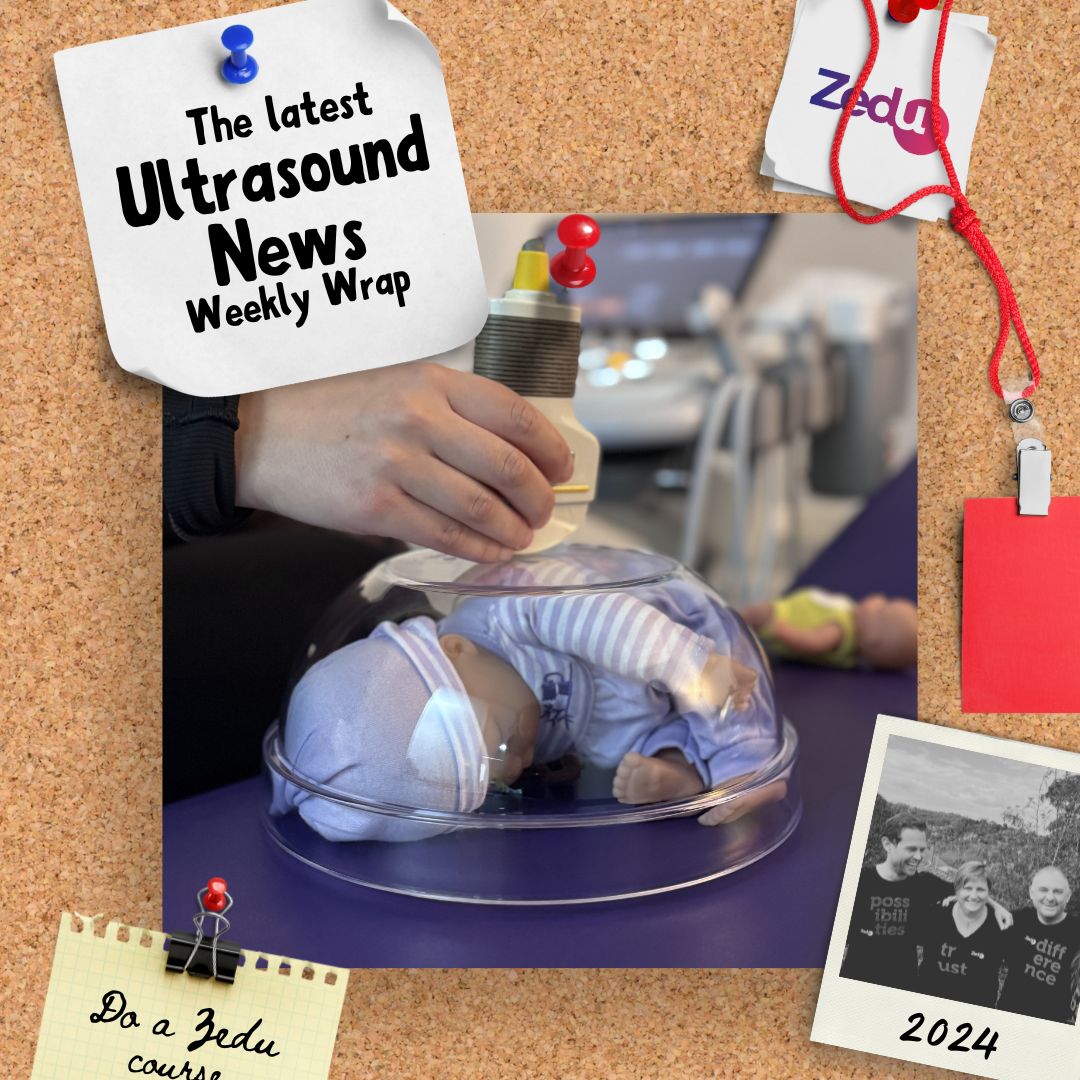 The Zedu weekly wrap - bringing together the best in free ultrasound news, views and opinions from across the internet.